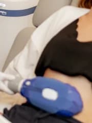 CoolSculpting Elite
